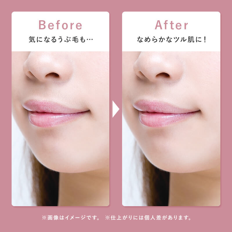 レディスシェーバー